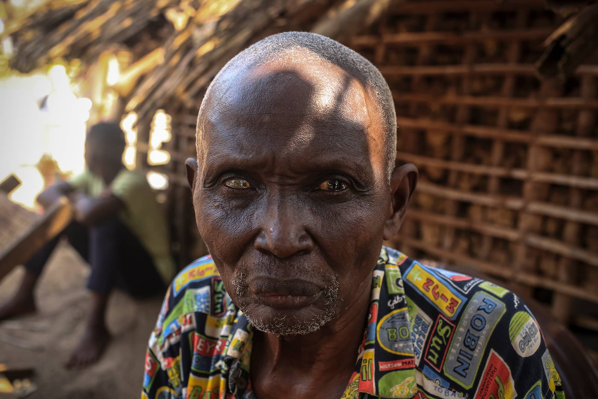 Man living with river blindness and impaired vision