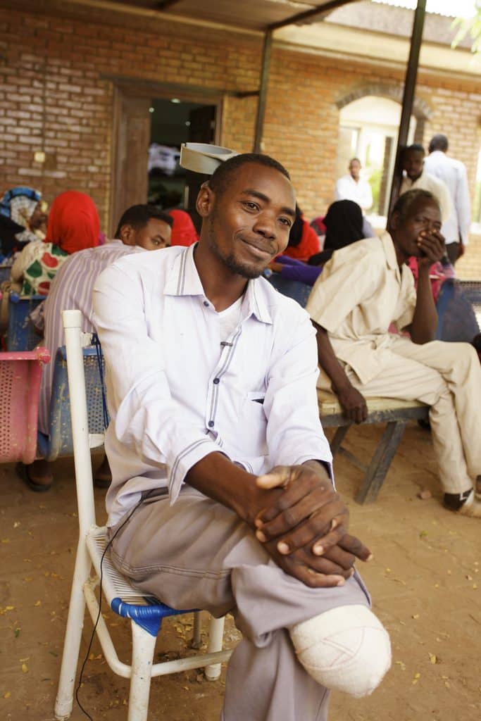 Alsadik Mohamed Musa -a patient who was amputated after having mycetoma for 19 years